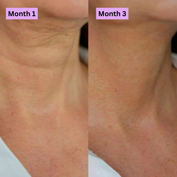 Anti-Wrinkle Firming Cream