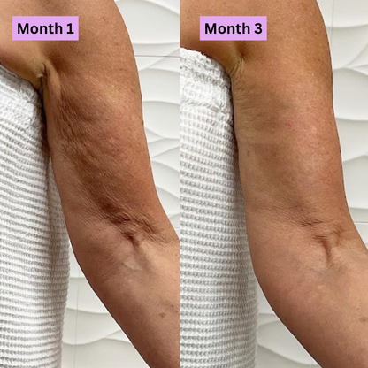Anti-Wrinkle Firming Cream
